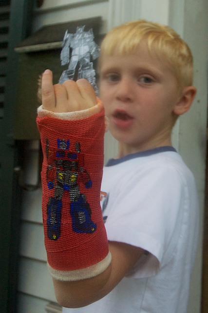 cast2